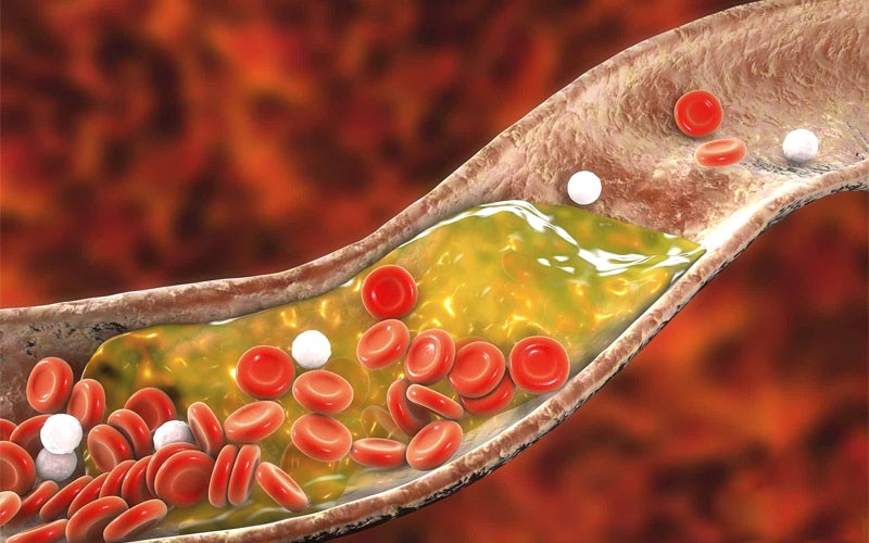 Nấm mỡ giảm cholesterol.