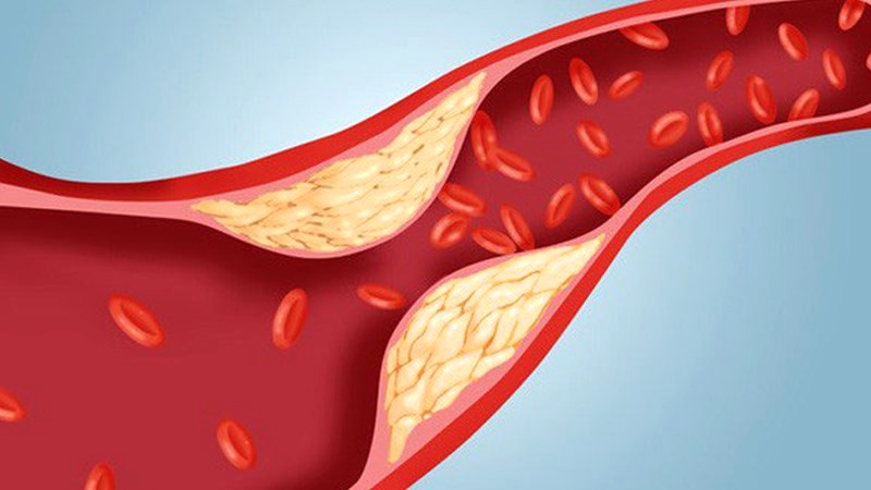 Giảm lượng cholesterol