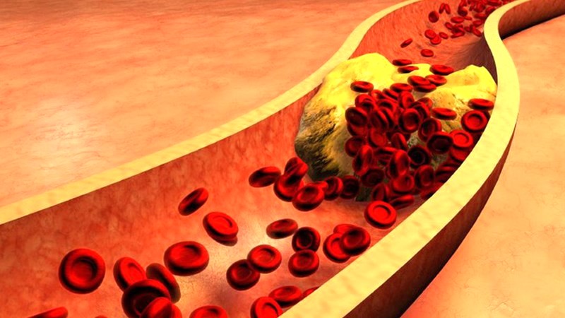 Giảm mức cholesterol